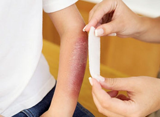 xu-ly-benh-nhan-bong1